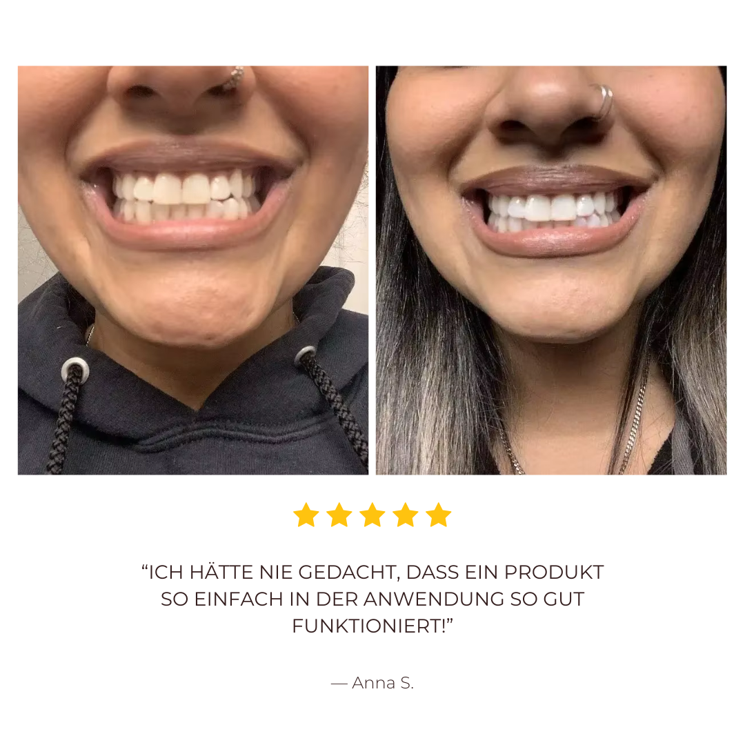 LumiSmile™ Der Zahnaufheller-Zahnpasta-Booster