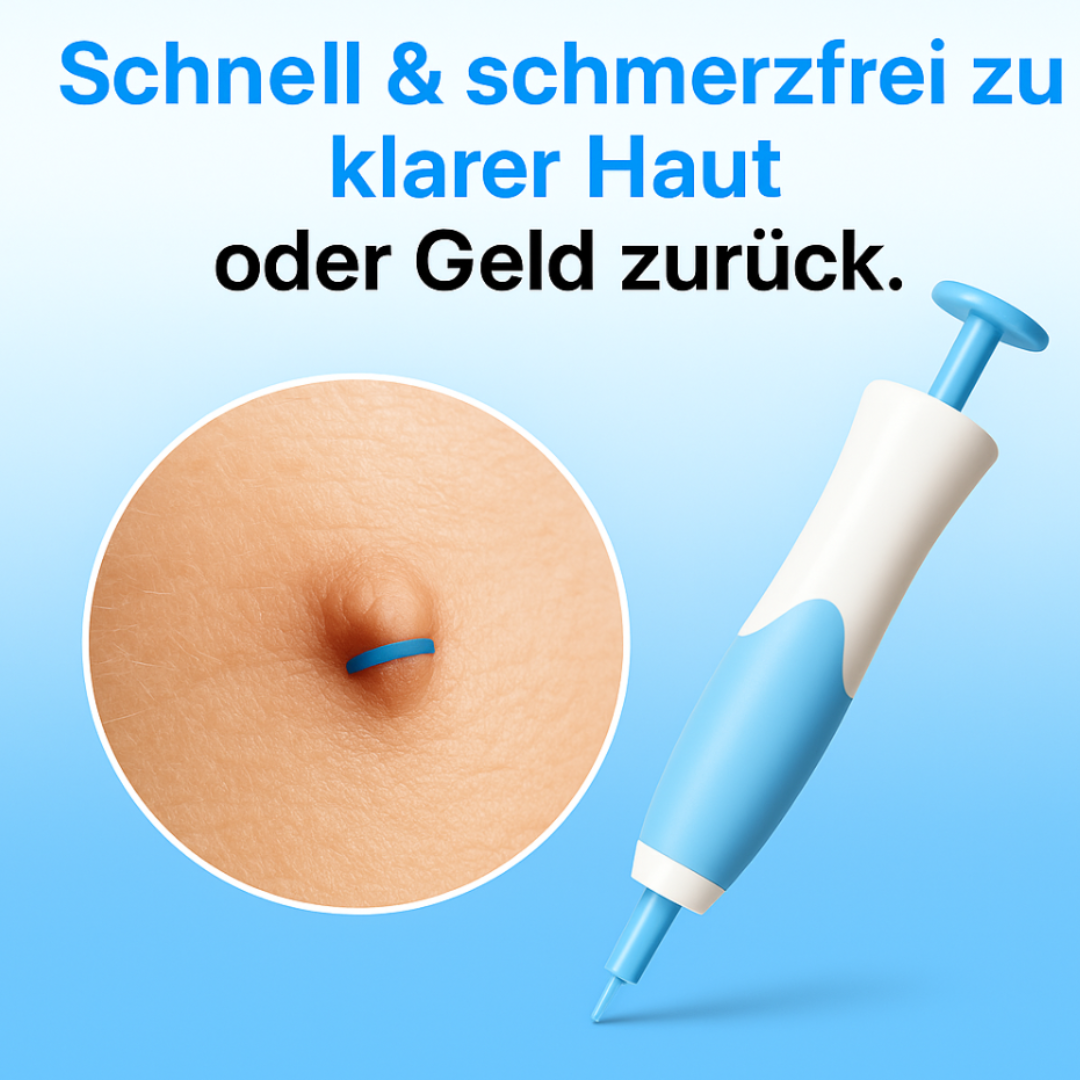 Dermazen™ - Der Stielwarzenentferner