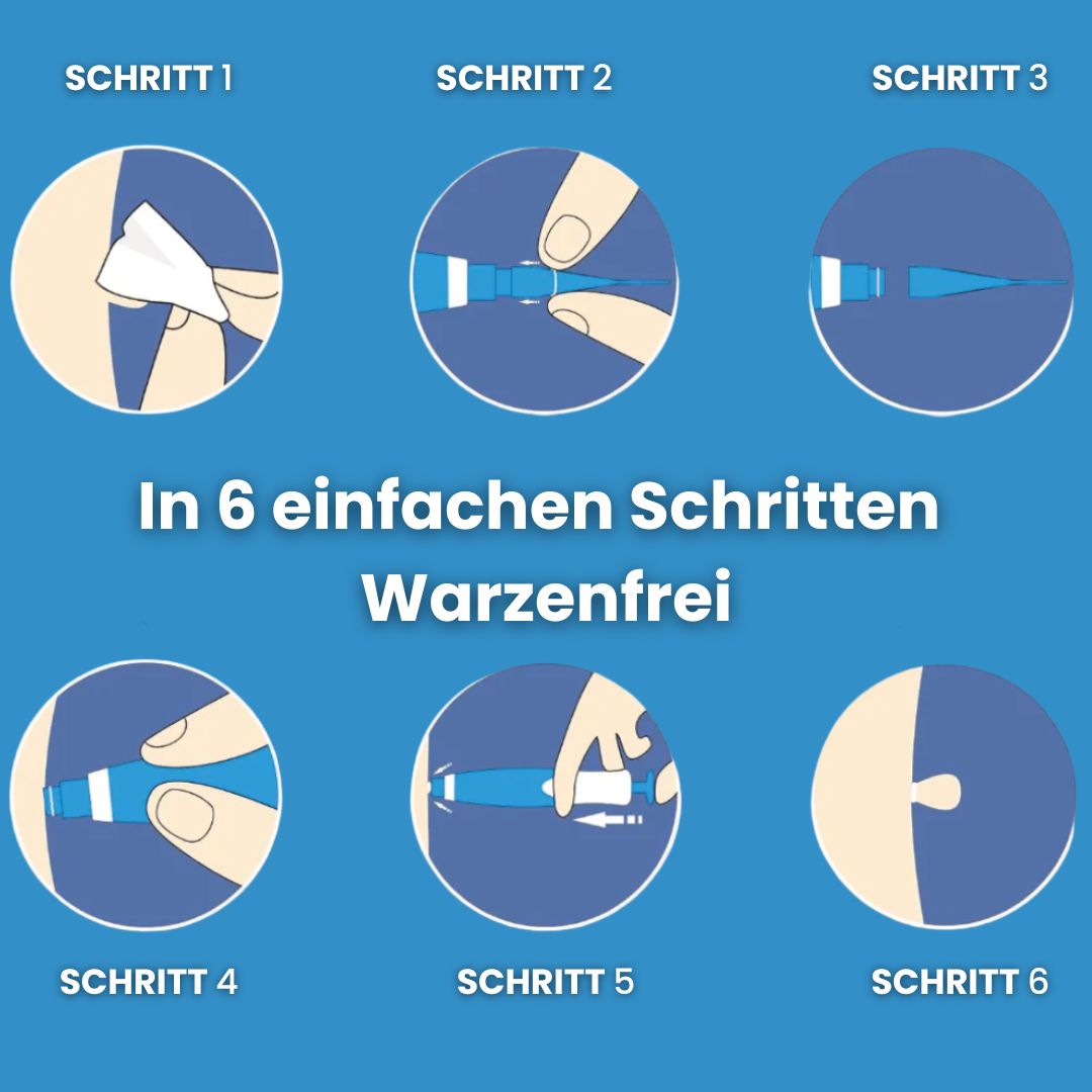 Dermazen™ - Der Stielwarzenentferner