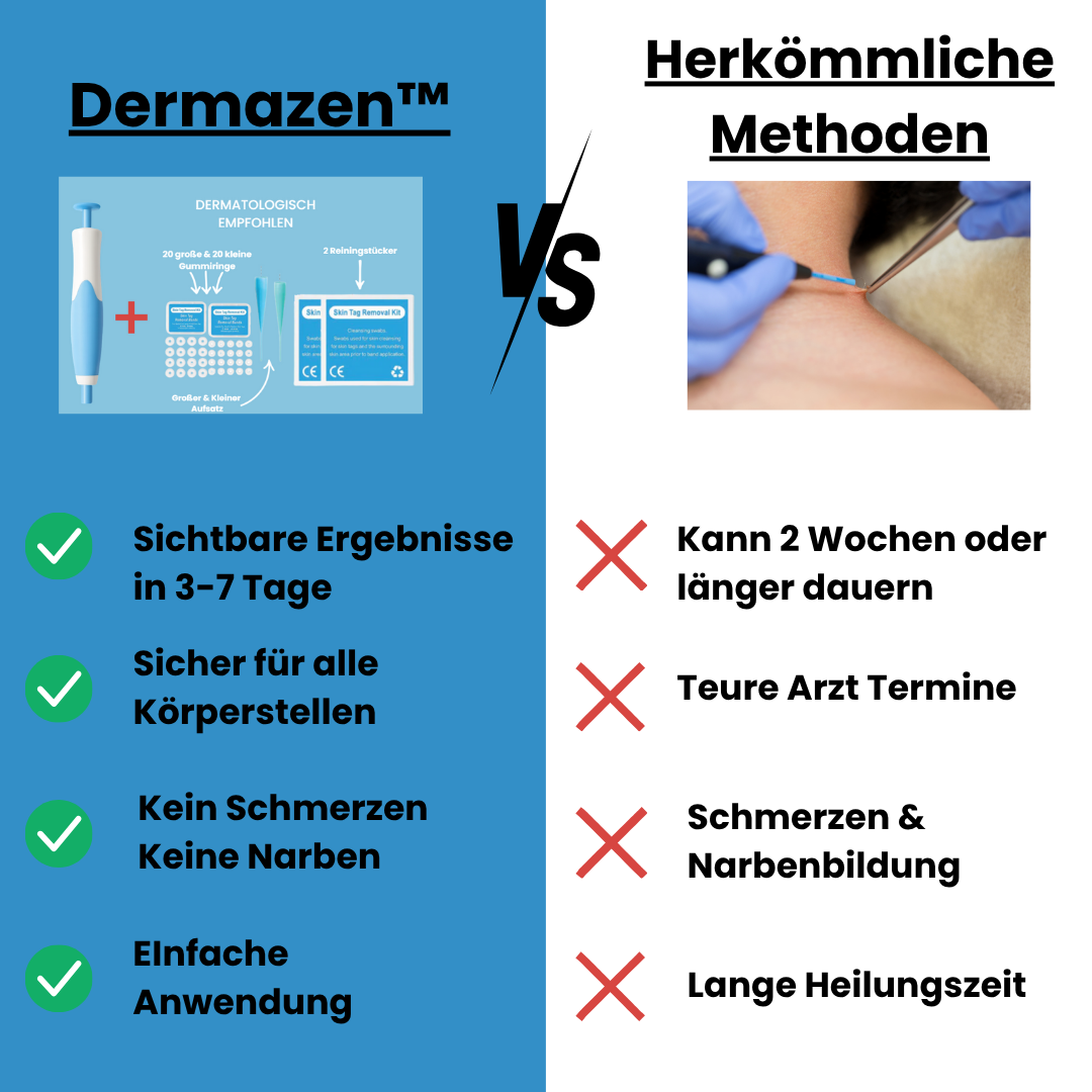 Dermazen™ - Der Stielwarzenentferner