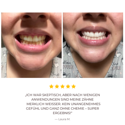 LumiSmile™ Der Zahnaufheller-Zahnpasta-Booster