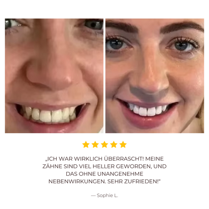 LumiSmile™ Der Zahnaufheller-Zahnpasta-Booster