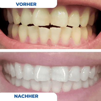 LumiSmile™ Der Zahnaufheller-Zahnpasta-Booster