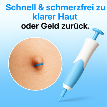 Dermazen™ - Der Stielwarzenentferner