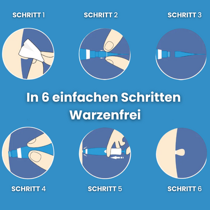 Dermazen™ - Der Stielwarzenentferner