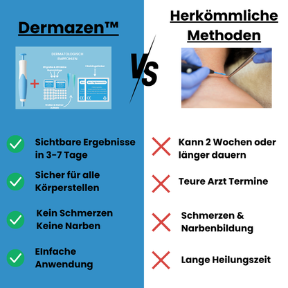Dermazen™ - Der Stielwarzenentferner